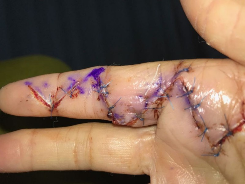 hand stitches v2