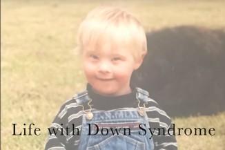life with down syndrome